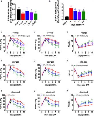 S1P/S1PR1 signaling is involved in the development of nociceptive pain